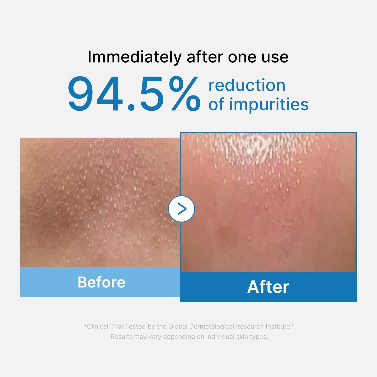 zero-pore-blackhead-deep-cleansing-oil-v8 01_eed557ec-5857-46a2-8b17-dbd67c692dcb.jpg