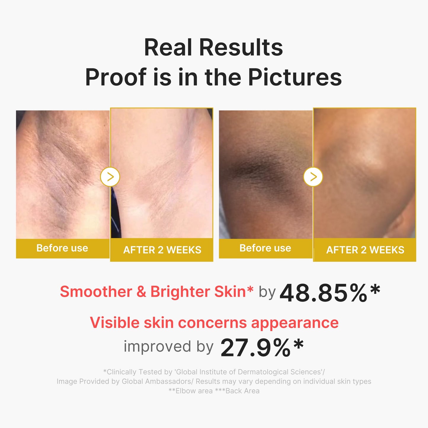 kojic-acid-turmeric-body-peel-shot-a3 02_72880cfc-382b-440b-8152-7e3dce87da2a.jpg