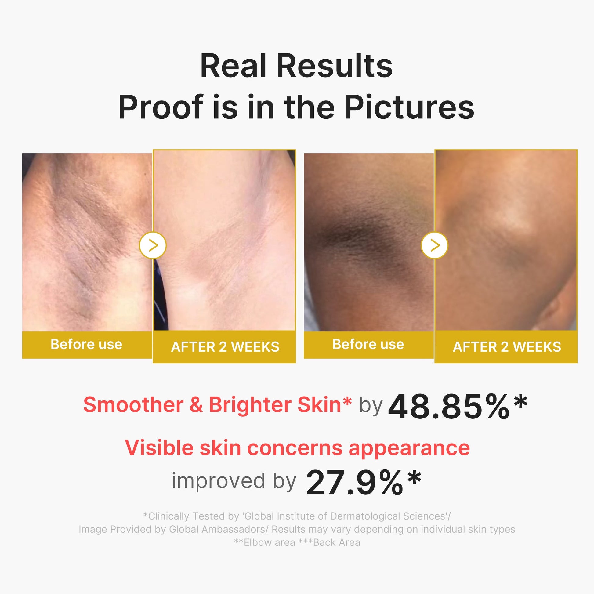 kojic-acid-turmeric-body-peel-shot-a3 02_72880cfc-382b-440b-8152-7e3dce87da2a.jpg