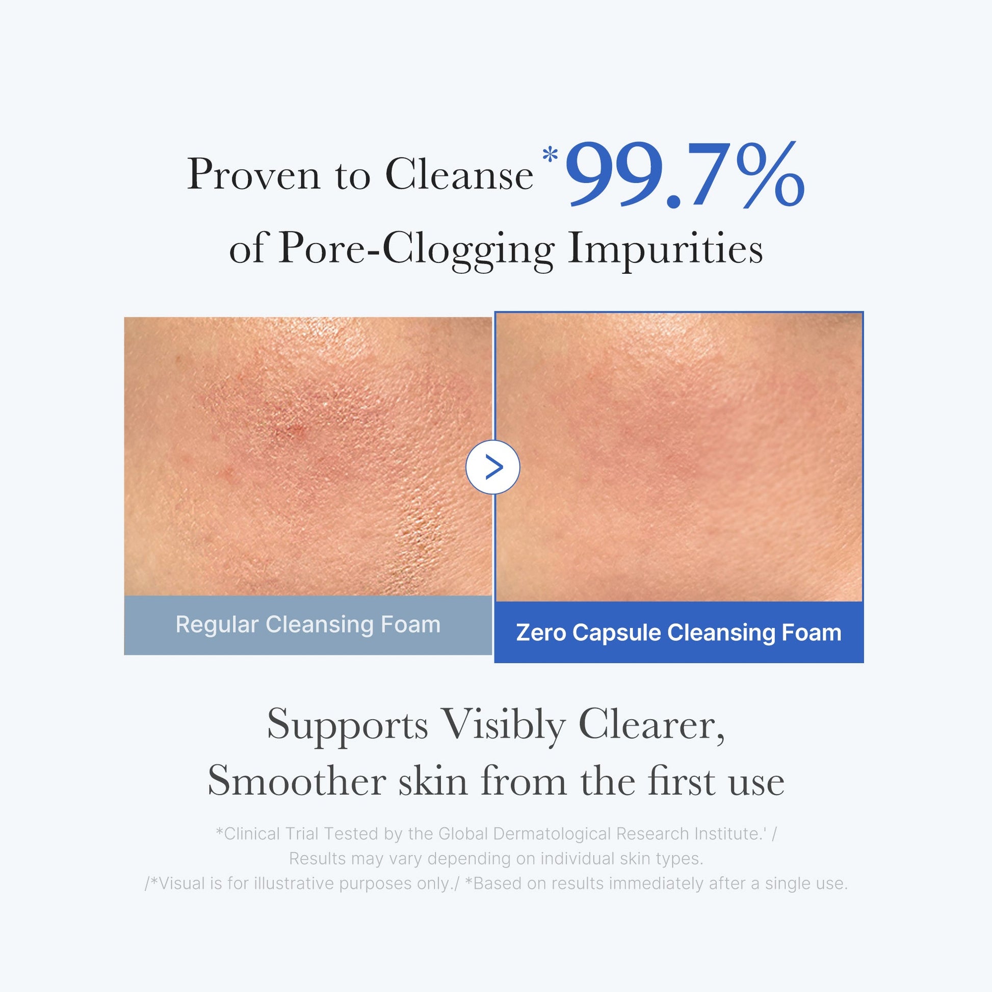 zero-pore-capsule-cleansing-foam-h6 02_c1fb9dfb-86c5-4038-8ff8-490d1006276c.jpg