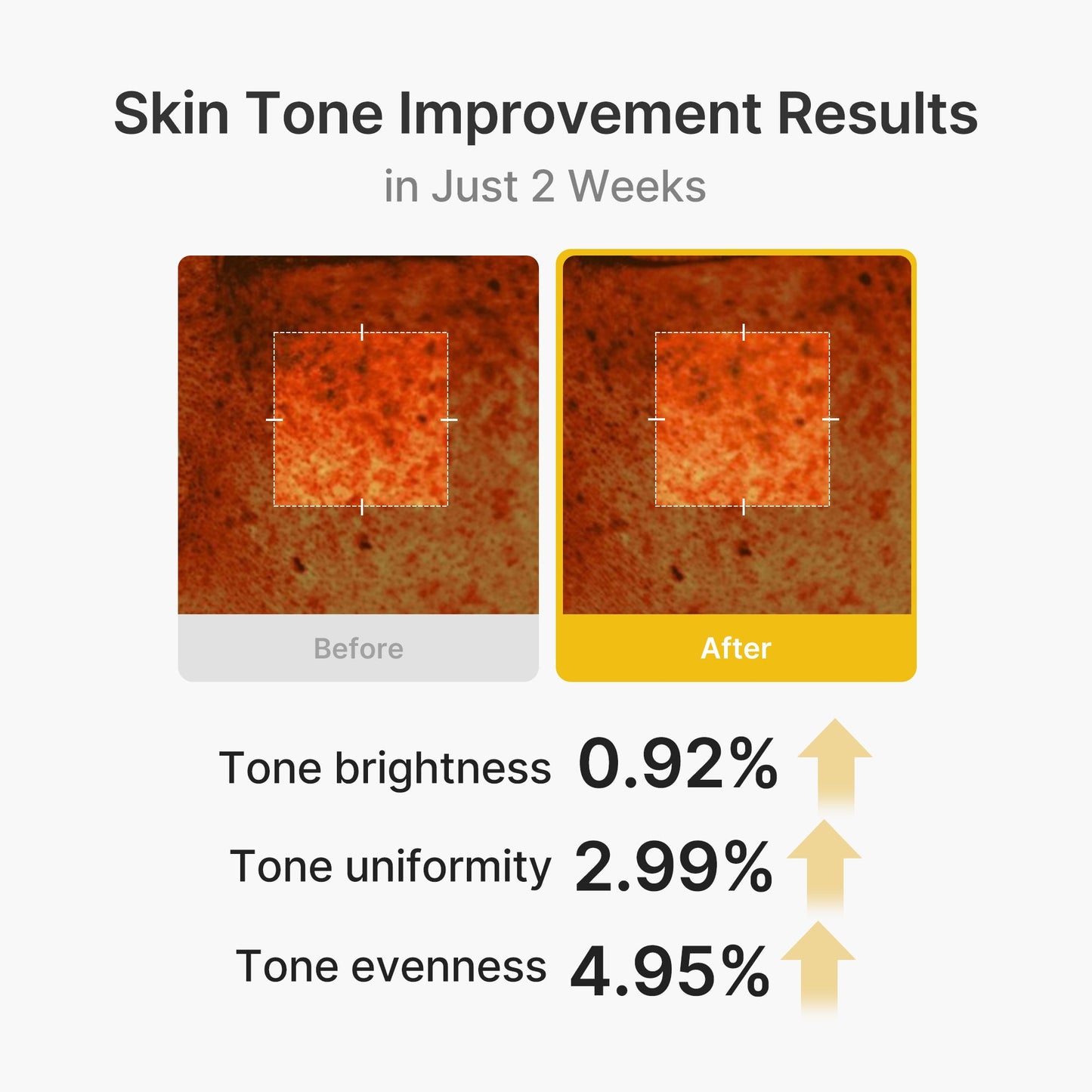 kojic-acid-turmeric-vita-capsule-cream-z3 03_2b626701-fc6c-4702-9e96-a2157a4f7f9d.jpg