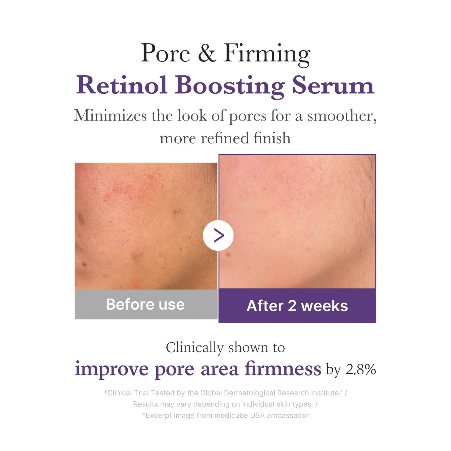 retinol-nmn-boosting-serum-u9 03_3510e7a5-5633-4a18-81ea-1389593bd517.jpg