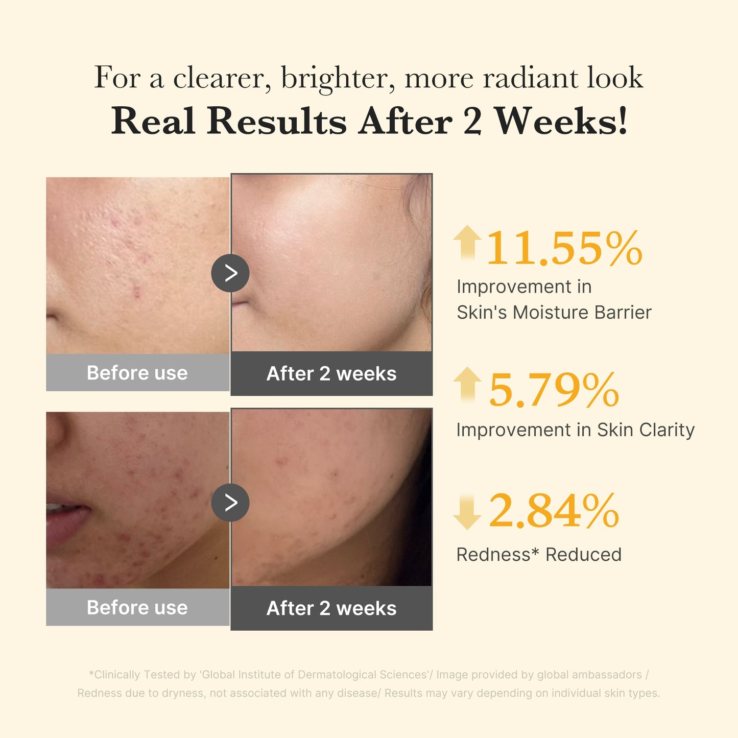 kojic-acid-turmeric-capsule-serum-r0 03_436487f5-76df-490e-8a61-01118373efbd.jpg