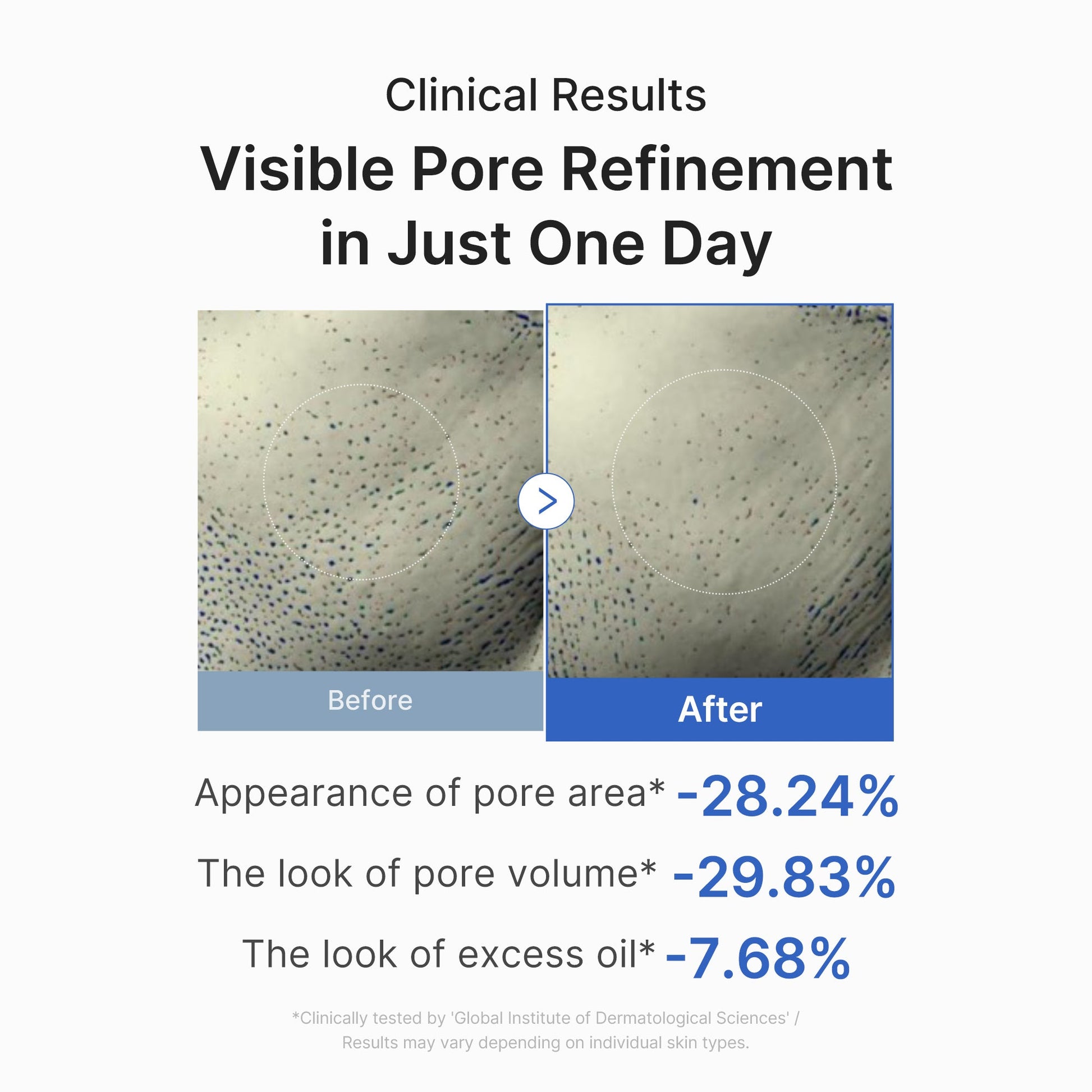 zero-pore-one-day-peptide-serum-v2 03_448eab9e-dc60-4dcb-9e4e-e863aabb61b0.jpg