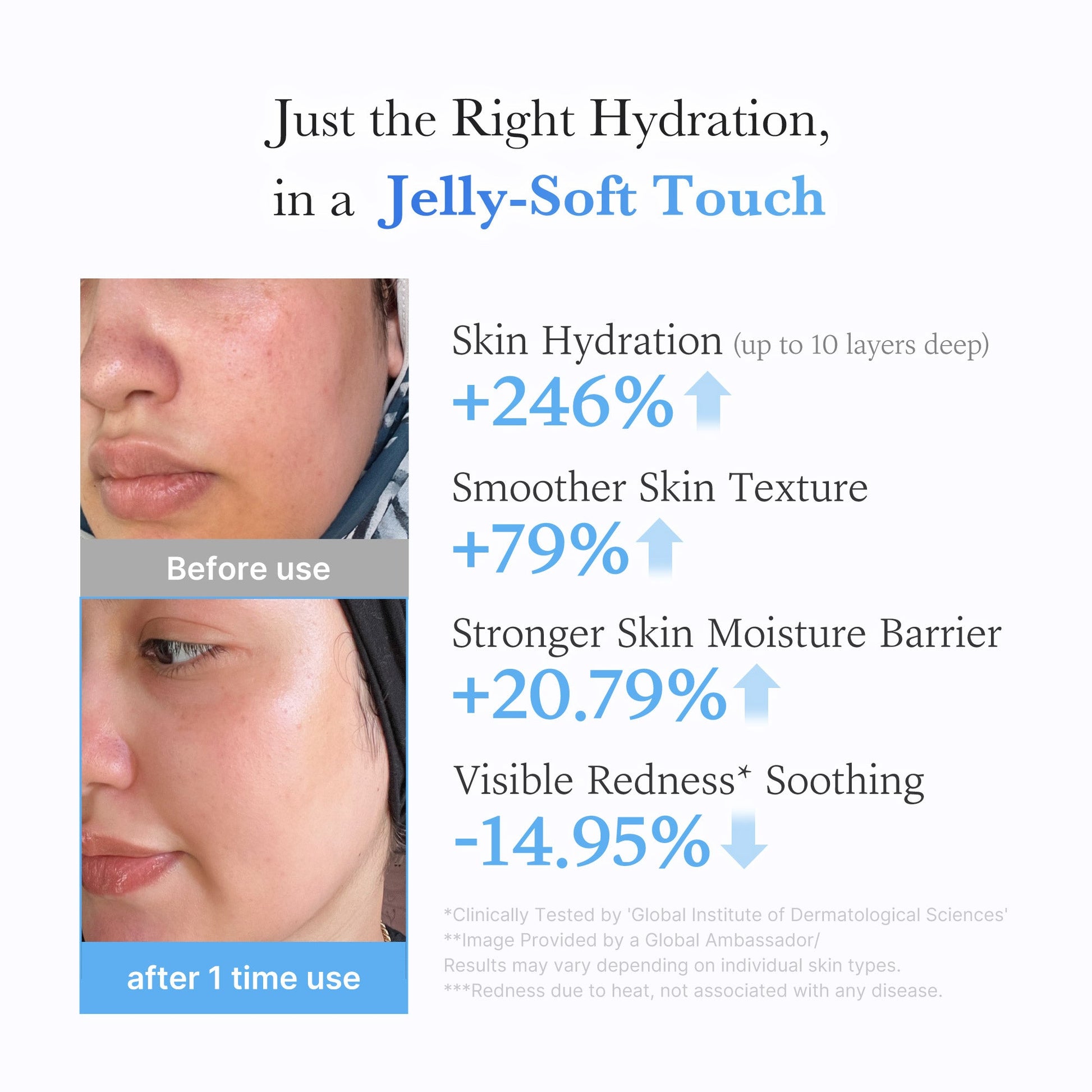 hyaluronic-ceramide-moisturizing-jelly-cream-g0 03_c39d66cc-0839-4e48-ab4a-d32143d06b1c.jpg
