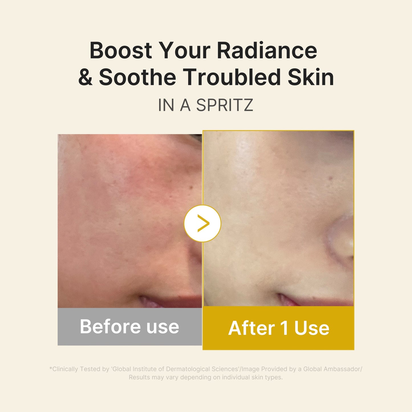 kojic-acid-turmeric-vitamin-gold-jelly-mist-serum-q3 03_dc9cd19e-4e57-49d3-9b66-c7762e8a63f1.jpg