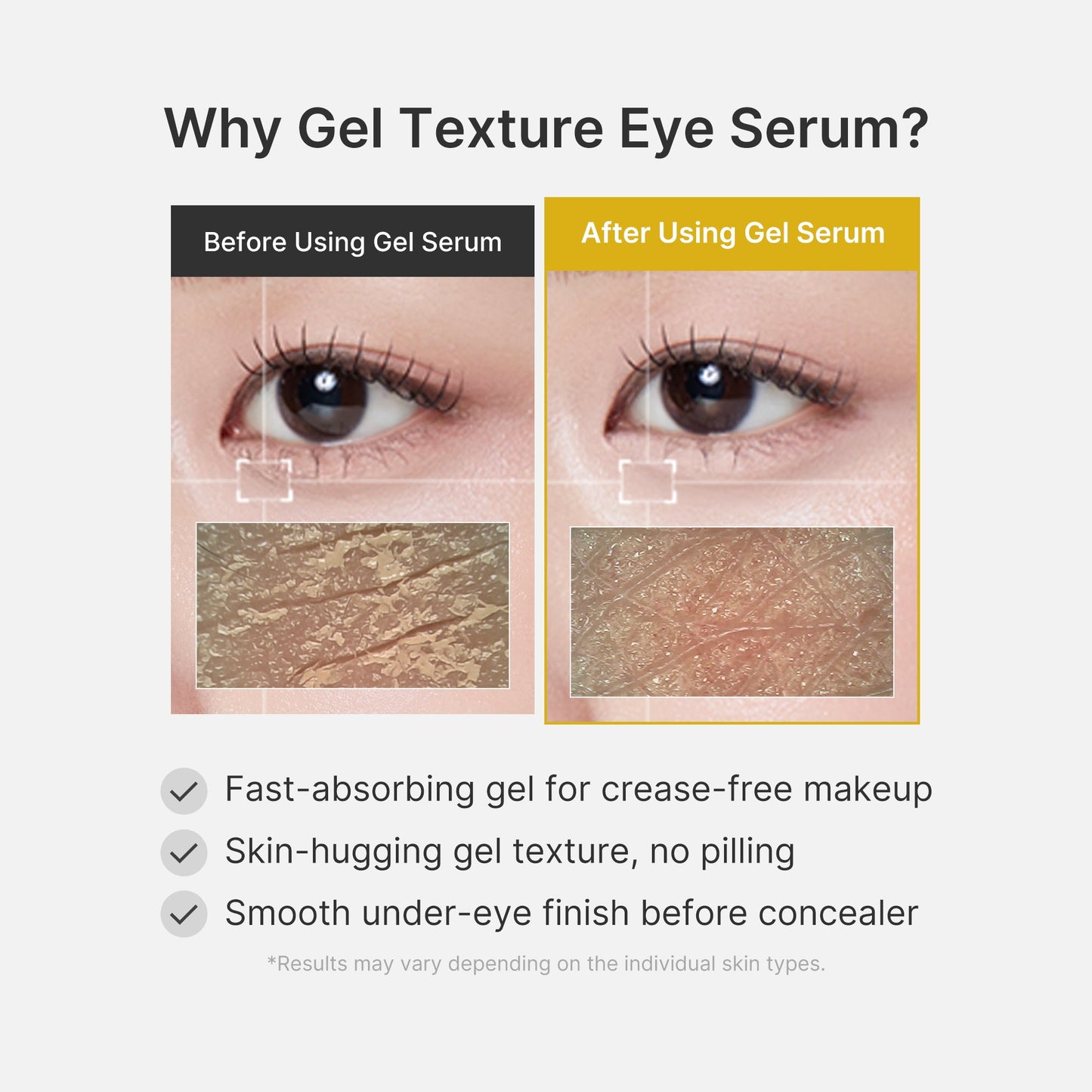 kojic-acid-tumeric-eye-gel-serum-e1 04_0487ef36-49f4-4294-8049-bb55118b05fe.jpg