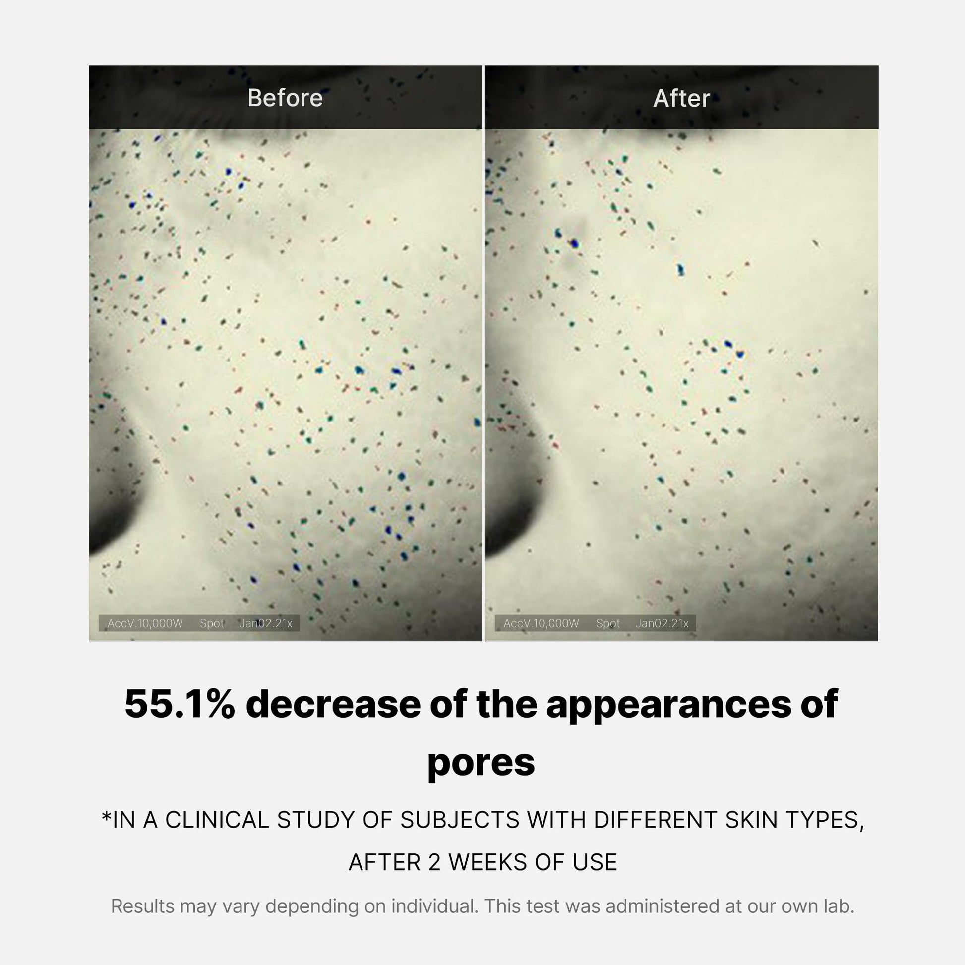 zero-pore-one-day-cream-v5 04_3616addc-f184-4deb-a5d7-e3a782e4713d.jpg