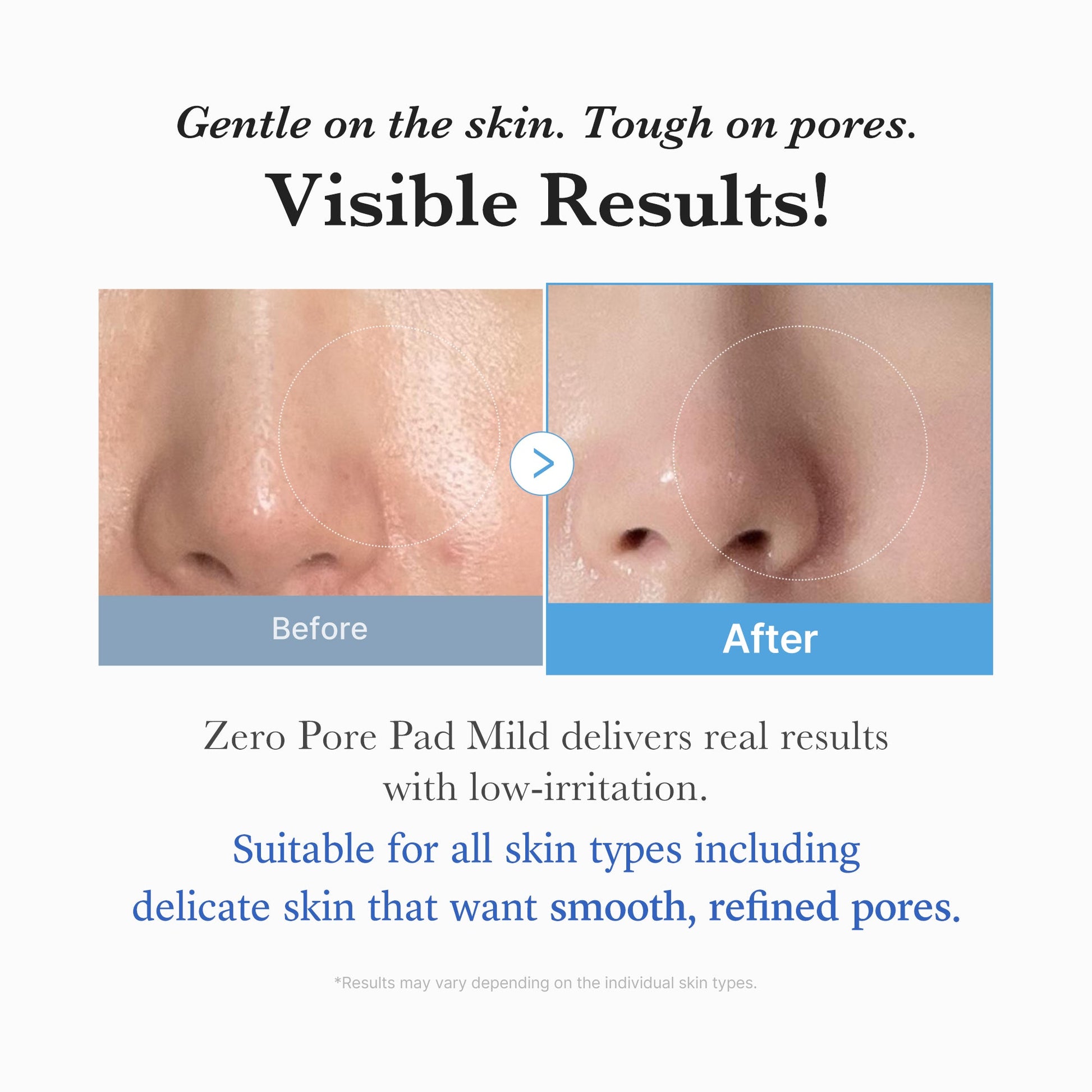zero-pore-madecassoside-pads-mild-u6 04_6357f9f9-483b-4891-82c6-a58d336e62c8.jpg