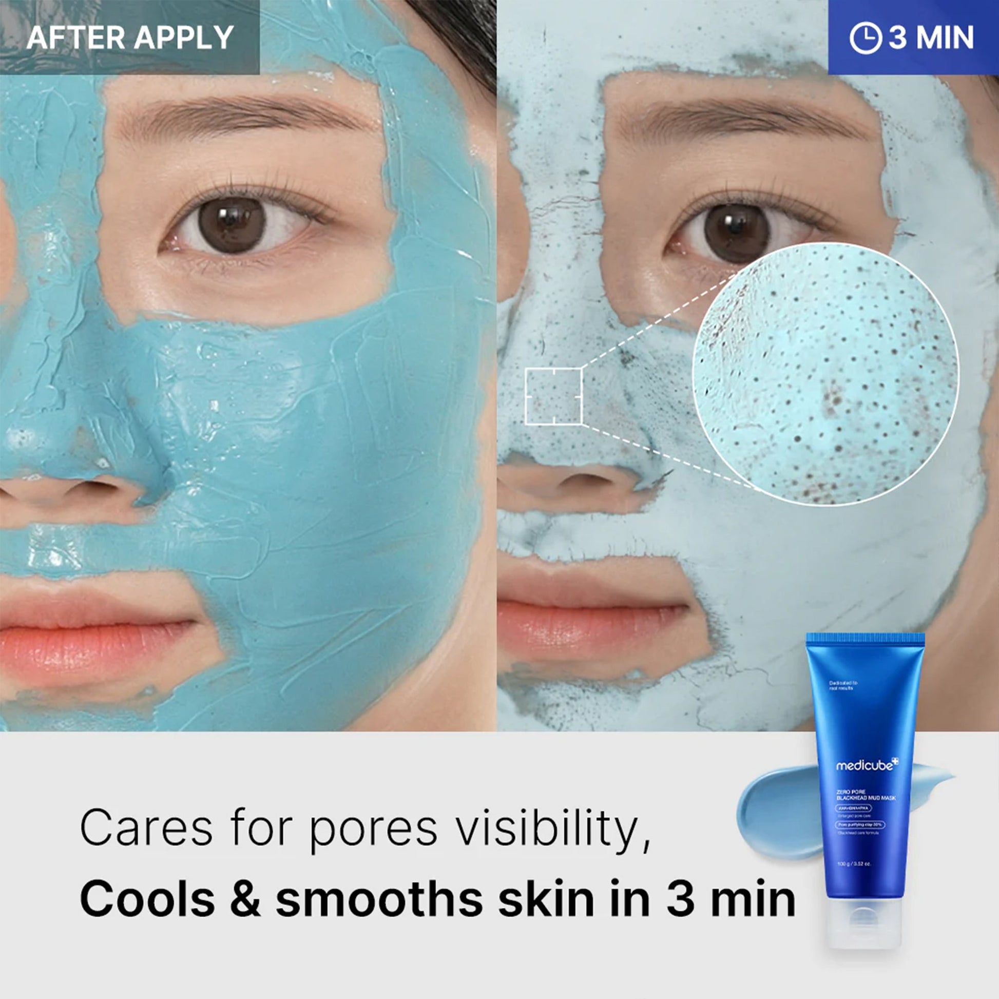 zero-pore-blackhead-mud-mask-z2 04_867c0459-a94e-40d3-bd9a-70400edabe8d.jpg