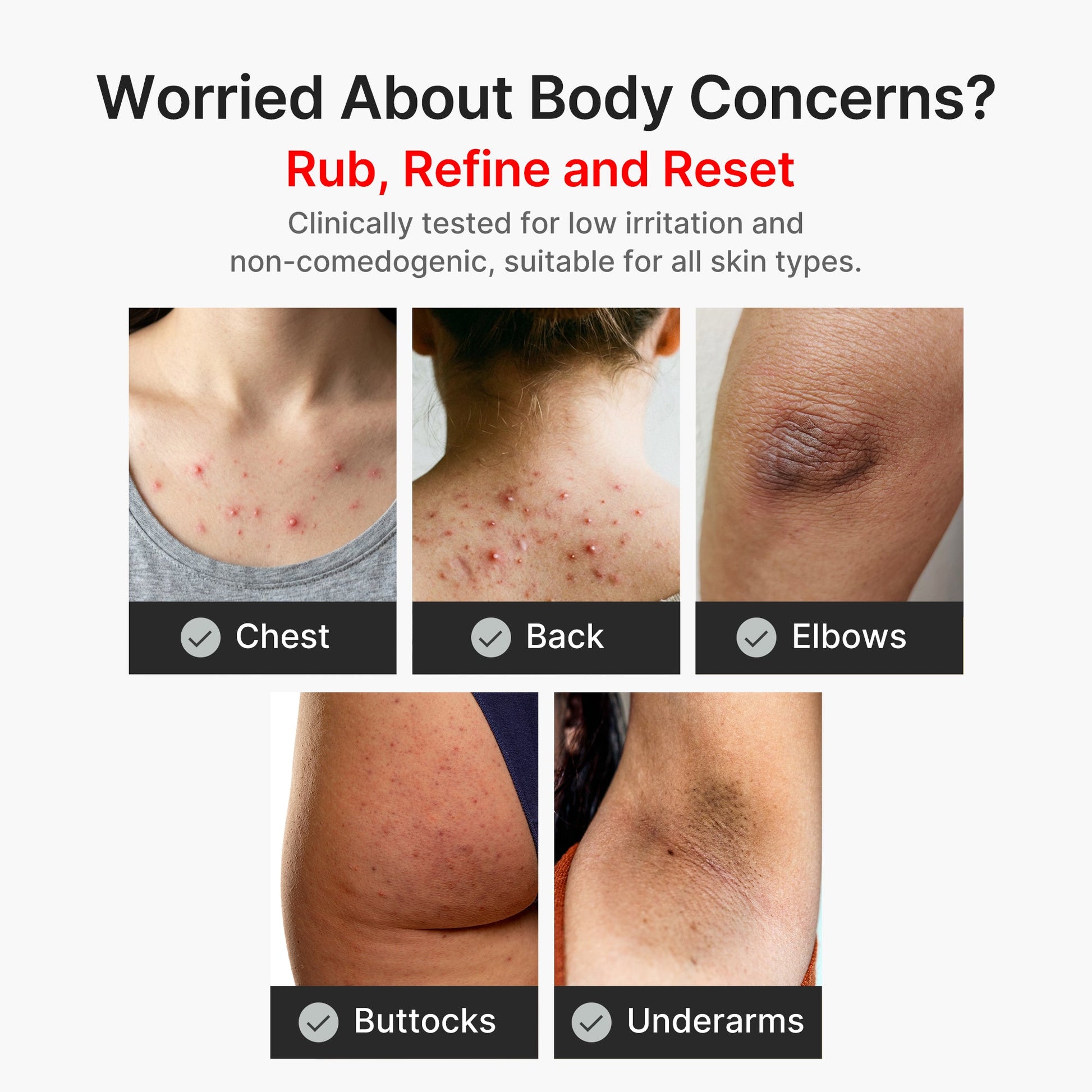 kojic-acid-turmeric-body-peel-shot-a3 04_8a7237f2-3ebf-401e-bd85-54841aeb3efc.jpg
