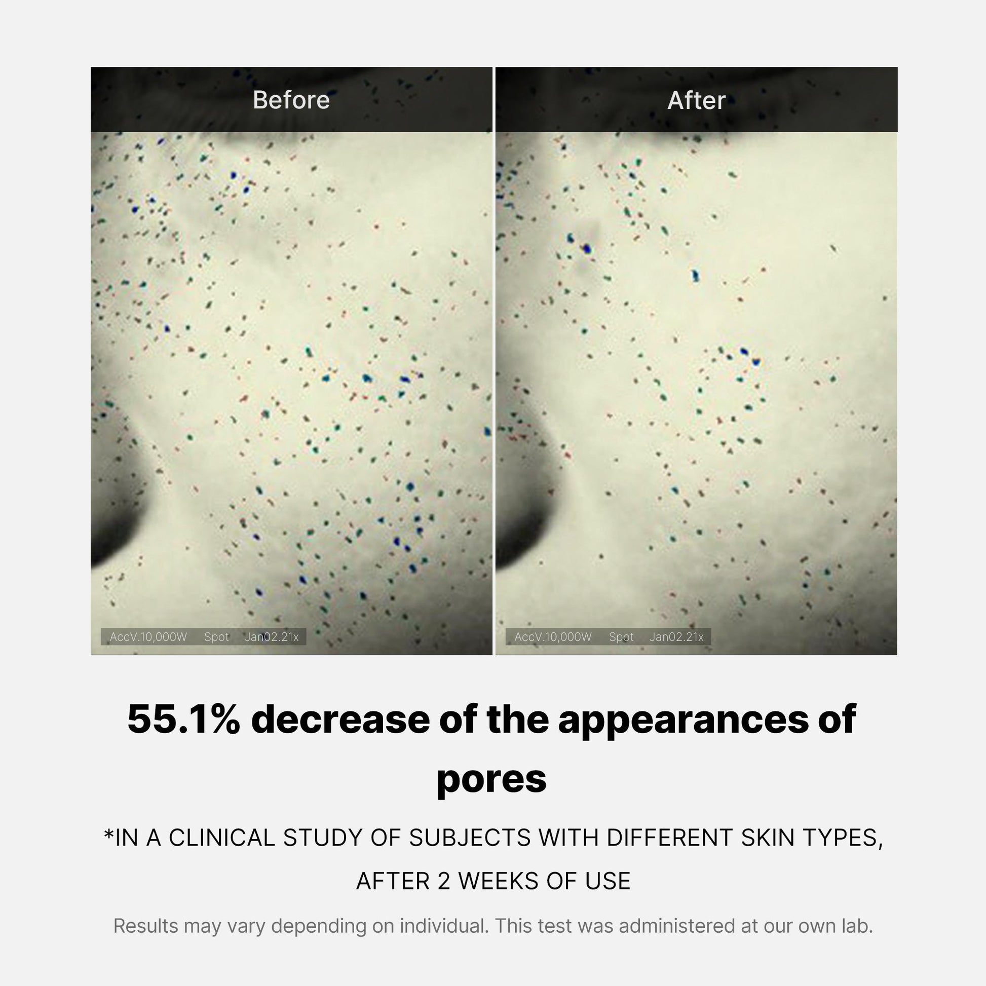 pore-care-duo-g8 05_12ddab8a-64be-4612-8ee1-27e5ec701921.jpg