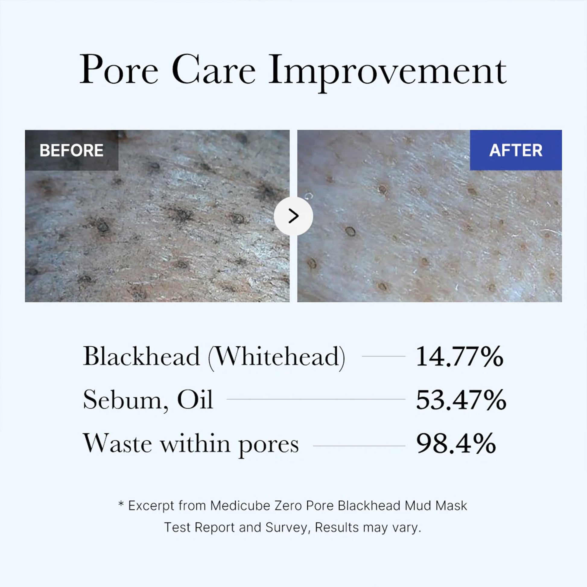 zero-pore-blackhead-mud-mask-z2 05_9362a158-c2b3-4525-acc0-631a2cfdea47.jpg