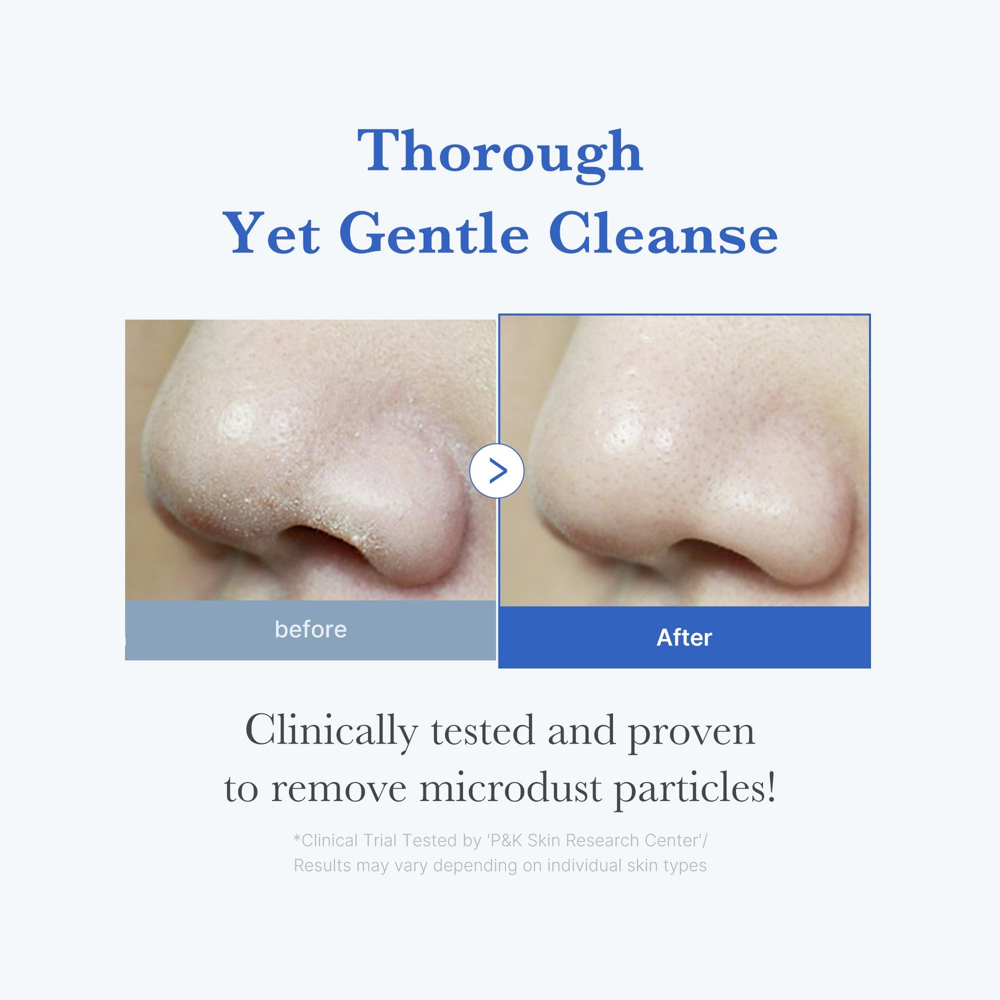 zero-foam-cleanser-t6 250702_ZeroCleanser3.jpg