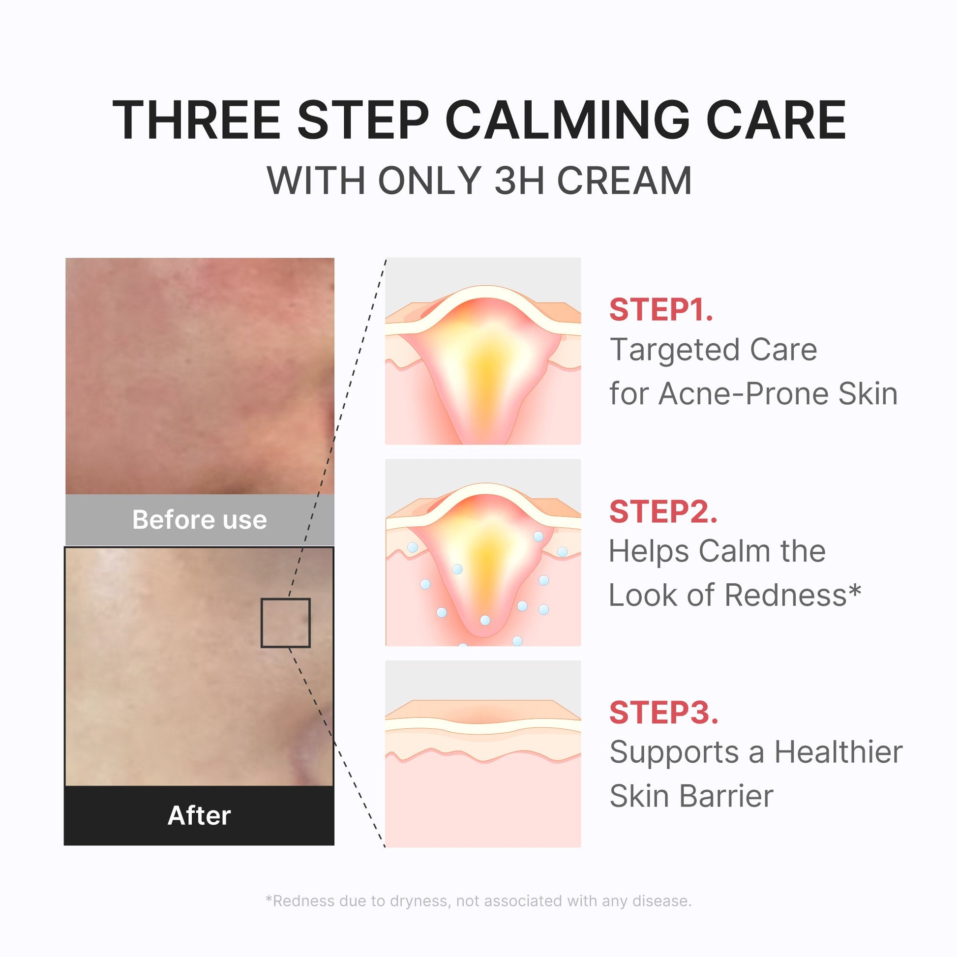 3h-daily-relief-cream-s8 3H_04.jpg