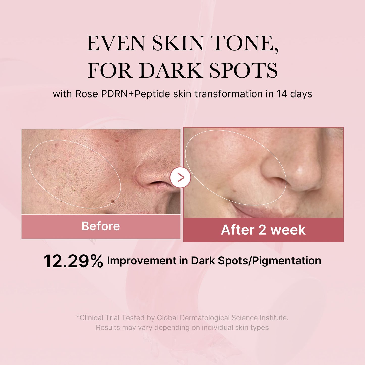 pdrn-pink-peptide-toner-d0 PDRN_01_308c518e-5ac6-4e54-99bd-eabc8796739b.jpg
