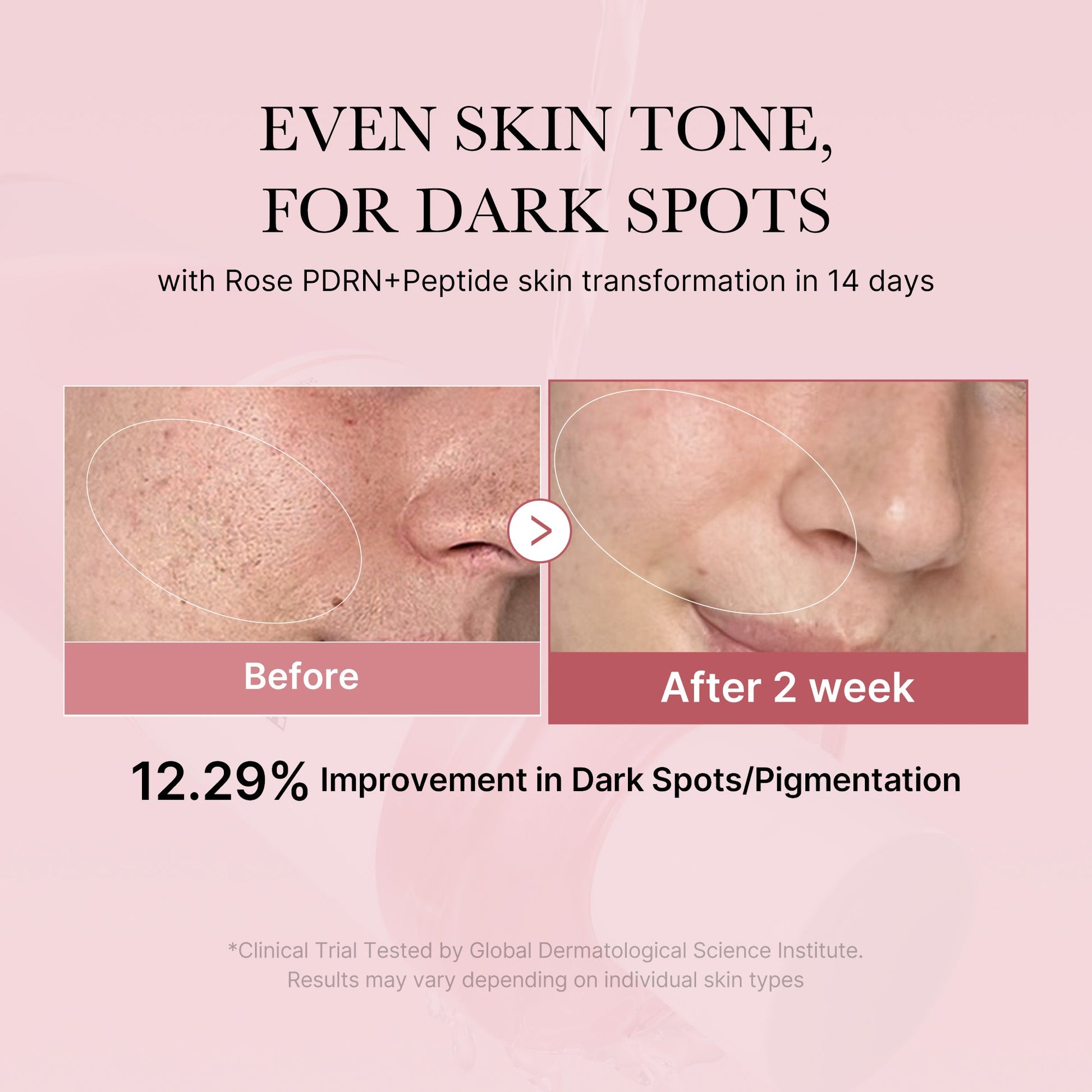 pdrn-pink-peptide-toner-d0 PDRN_01_308c518e-5ac6-4e54-99bd-eabc8796739b.jpg