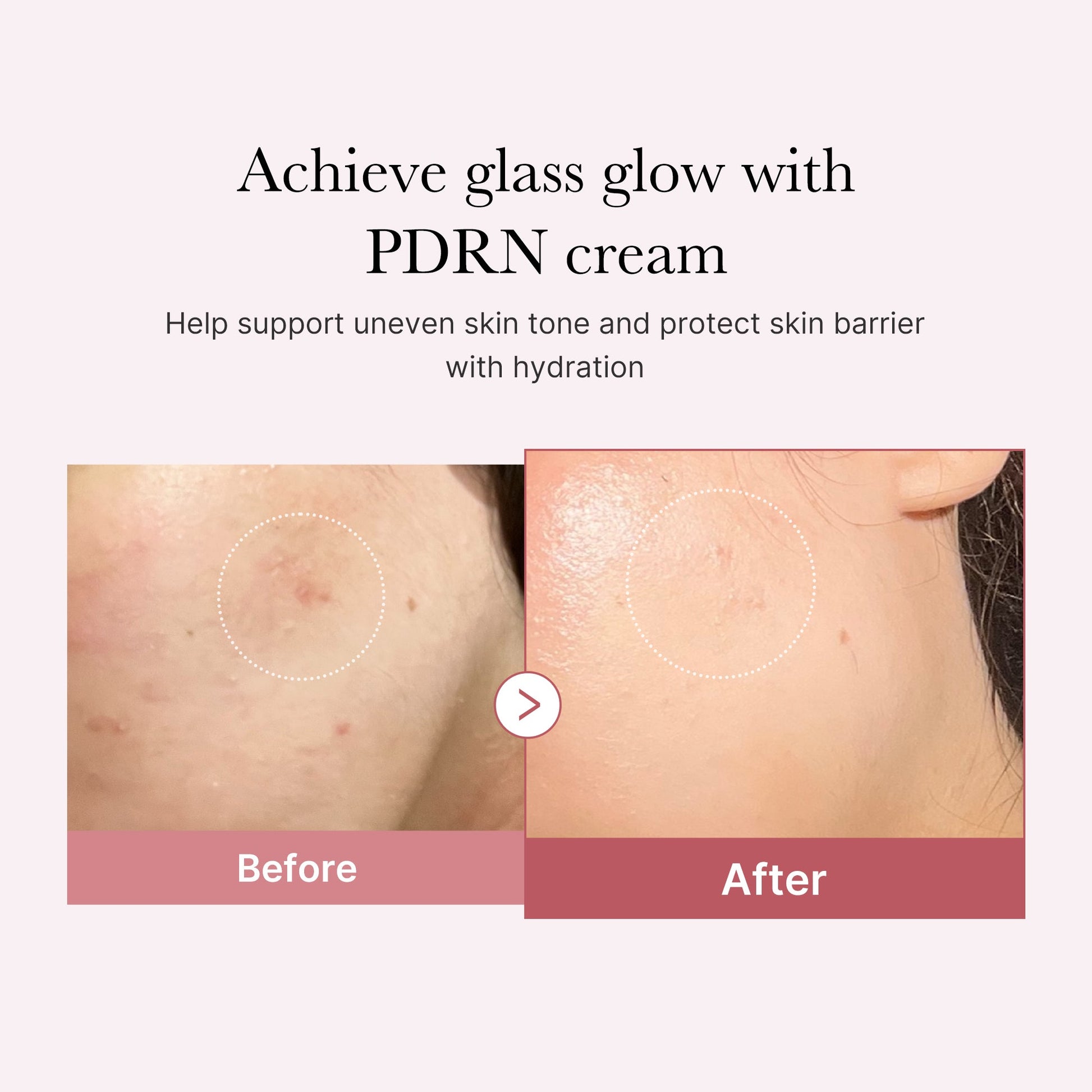 pdrn-pink-peptide-cream-l4 PDRN_02_d7805bfe-cf43-446a-b71b-a276683f136b.jpg