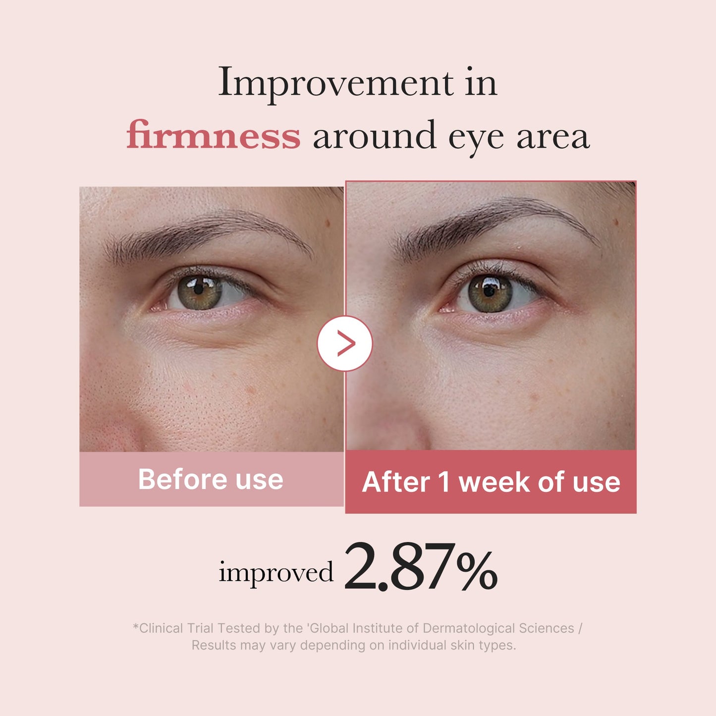 pdrn-pink-peptide-eye-cream-i7 PDRN_03_256dd753-0a2f-41b4-b3cd-bbfd3bc27018.jpg
