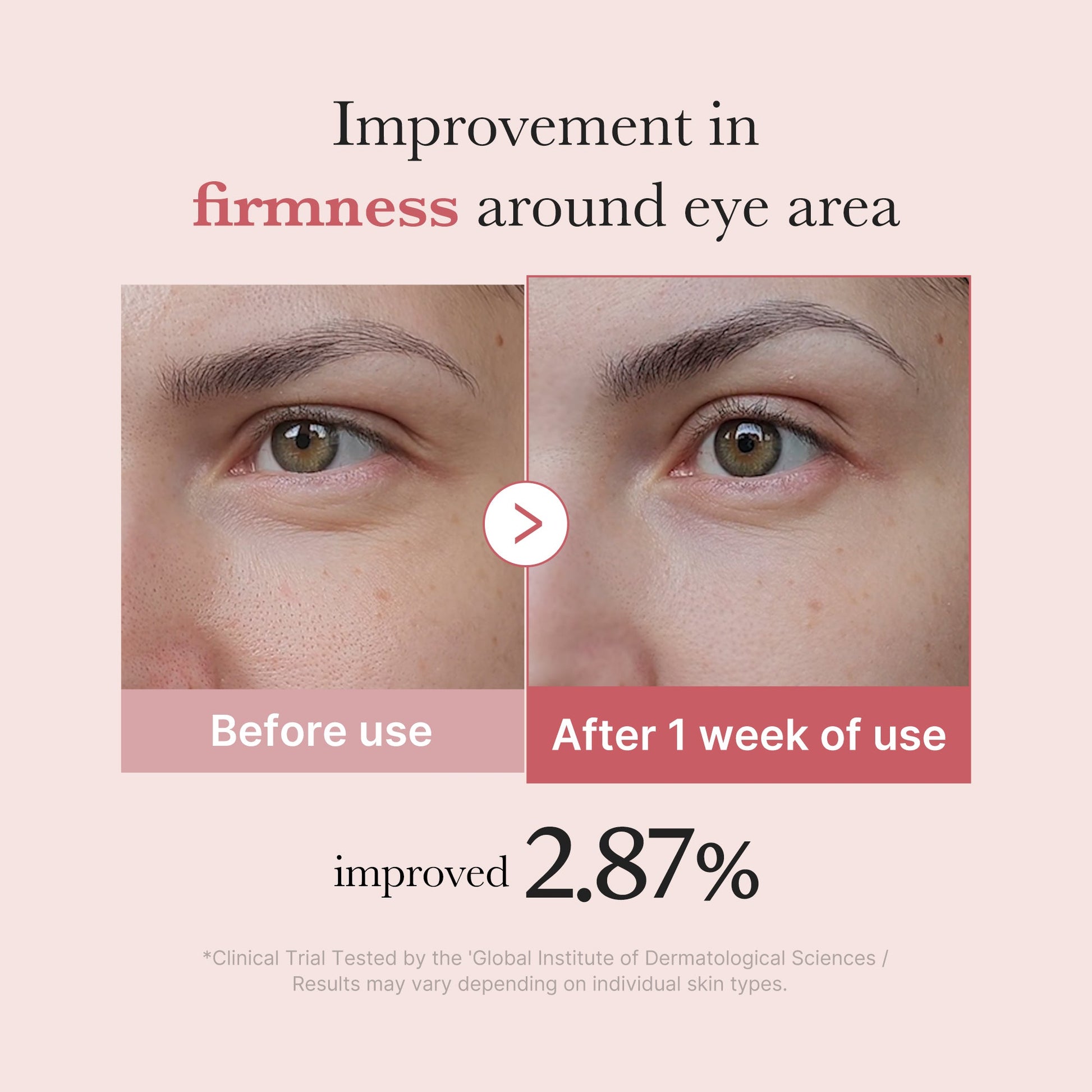 pdrn-pink-peptide-eye-cream-i7 PDRN_03_256dd753-0a2f-41b4-b3cd-bbfd3bc27018.jpg