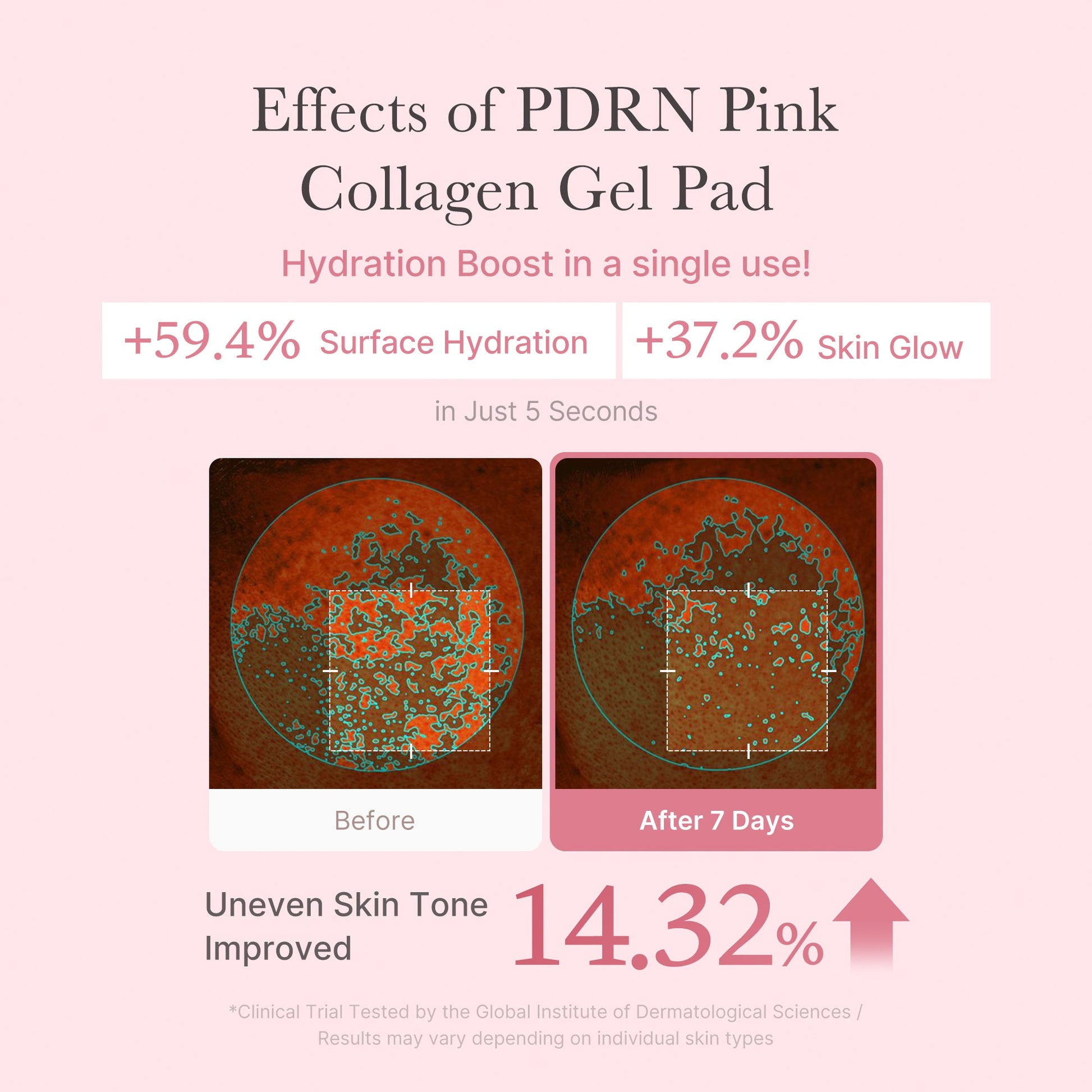 pdrn-pink-collagen-gel-toner-pad-u1 PDRN_04_f9a16a56-8d9e-4c47-a635-ed34ec3ed571.jpg
