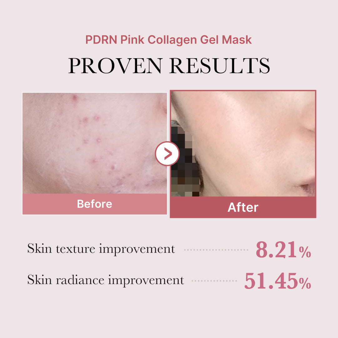 pdrn-pink-glow-full-set-d4 PDRN_12.jpg